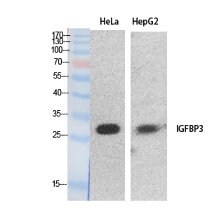 Western blot - IGFBP3 Polyclonal Antibody from Signalway Antibody (41888) - Antibodies.com