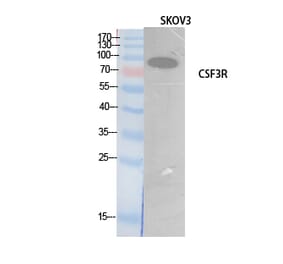 Western blot - G-CSFR Polyclonal Antibody from Signalway Antibody (41896) - Antibodies.com