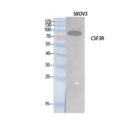 Western blot - G-CSFR Polyclonal Antibody from Signalway Antibody (41896) - Antibodies.com