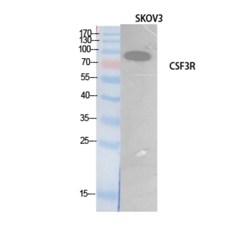 Western blot - G-CSFR Polyclonal Antibody from Signalway Antibody (41896) - Antibodies.com