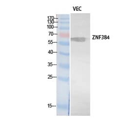 Western blot - ZNF384 Polyclonal Antibody from Signalway Antibody (41899) - Antibodies.com
