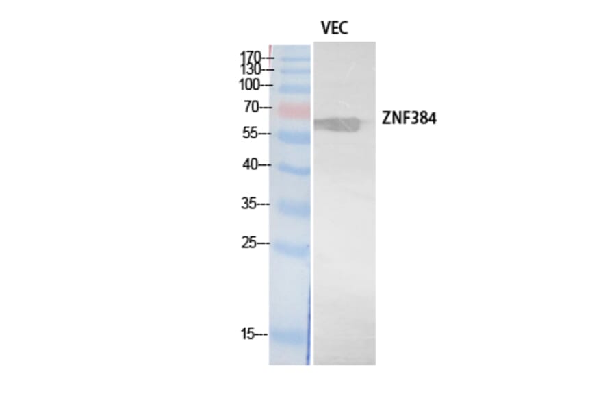 Western blot - ZNF384 Polyclonal Antibody from Signalway Antibody (41899) - Antibodies.com