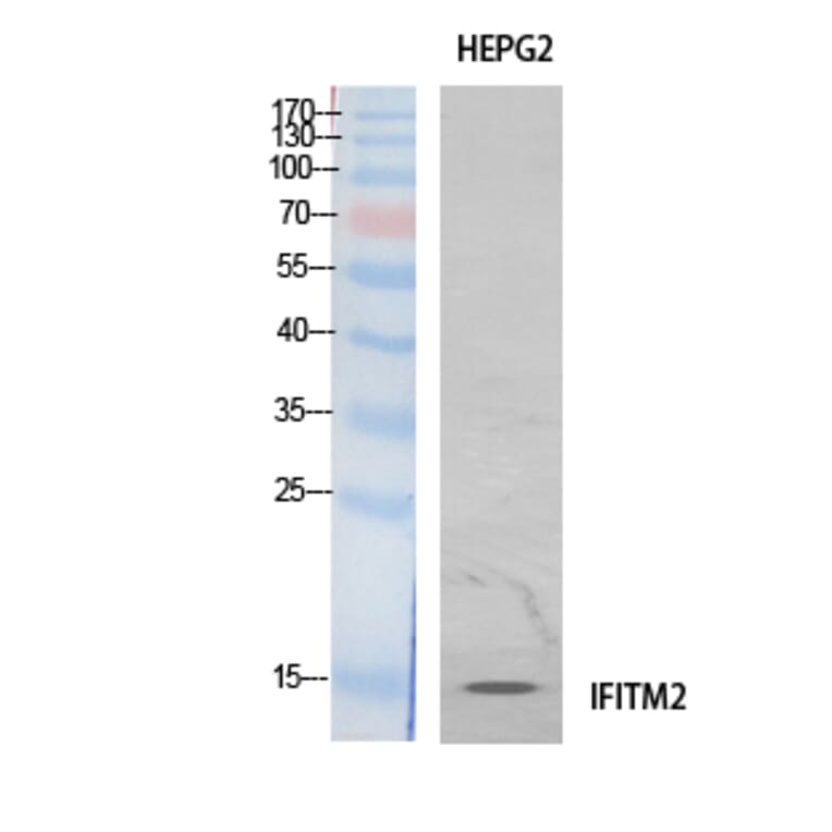 Western blot - IFITM2 Polyclonal Antibody from Signalway Antibody (41900) - Antibodies.com