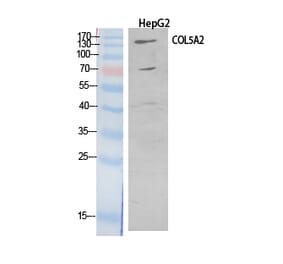 Western blot - COL5A2 Polyclonal Antibody from Signalway Antibody (41901) - Antibodies.com