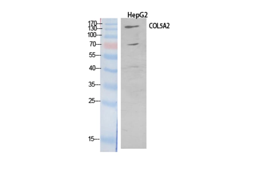 Western blot - COL5A2 Polyclonal Antibody from Signalway Antibody (41901) - Antibodies.com