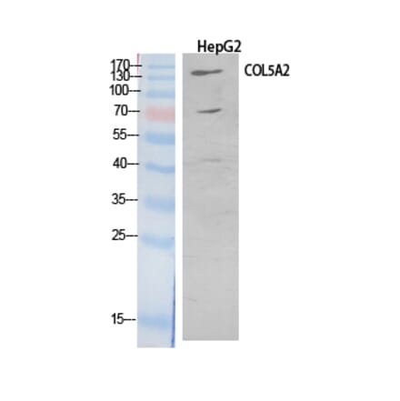 Western blot - COL5A2 Polyclonal Antibody from Signalway Antibody (41901) - Antibodies.com