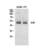Western blot - IL-6Rα Polyclonal Antibody from Signalway Antibody (41912) - Antibodies.com