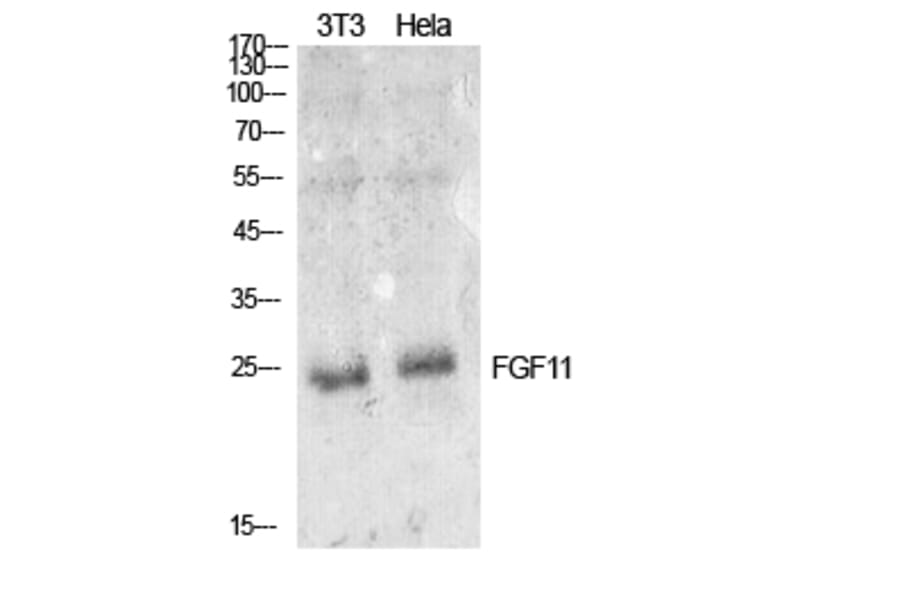 Western blot - FGF-11 Polyclonal Antibody from Signalway Antibody (41913) - Antibodies.com