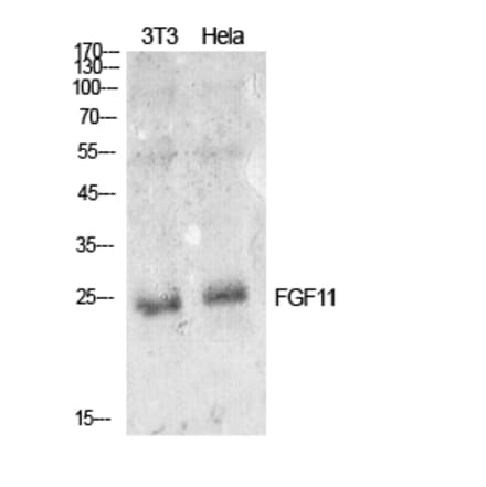 Western blot - FGF-11 Polyclonal Antibody from Signalway Antibody (41913) - Antibodies.com