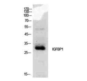 Western blot - IGFBP1 Polyclonal Antibody from Signalway Antibody (41933) - Antibodies.com