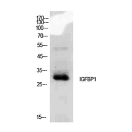 Western blot - IGFBP1 Polyclonal Antibody from Signalway Antibody (41933) - Antibodies.com