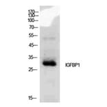 Western blot - IGFBP1 Polyclonal Antibody from Signalway Antibody (41933) - Antibodies.com