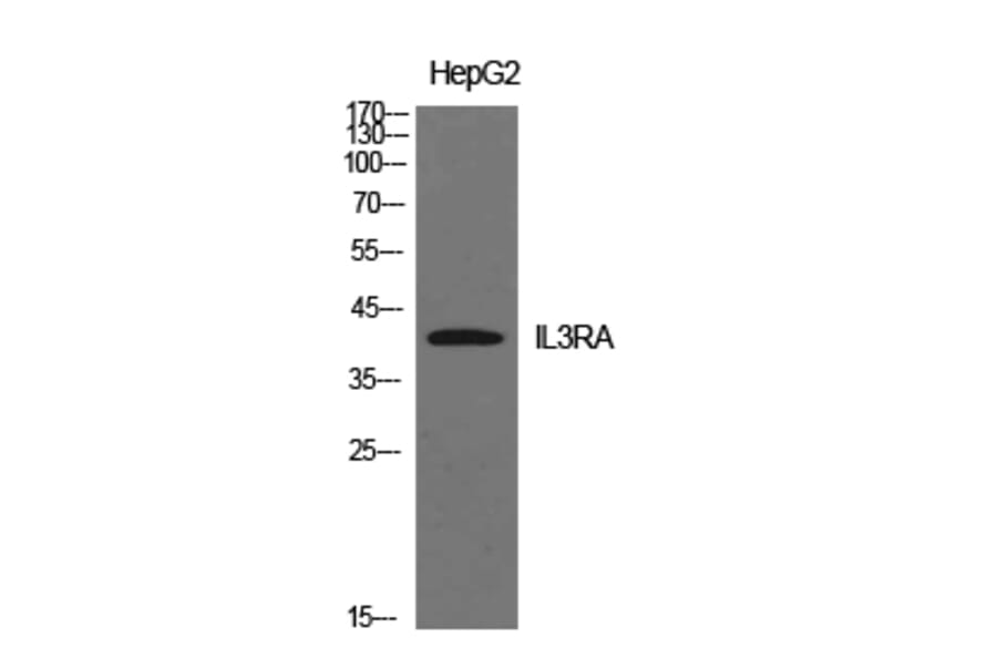 Western blot - IL-3Rα Polyclonal Antibody from Signalway Antibody (41936) - Antibodies.com