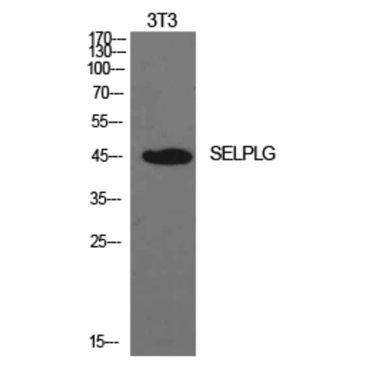 Western blot - PSGL-1 Polyclonal Antibody from Signalway Antibody (41938) - Antibodies.com