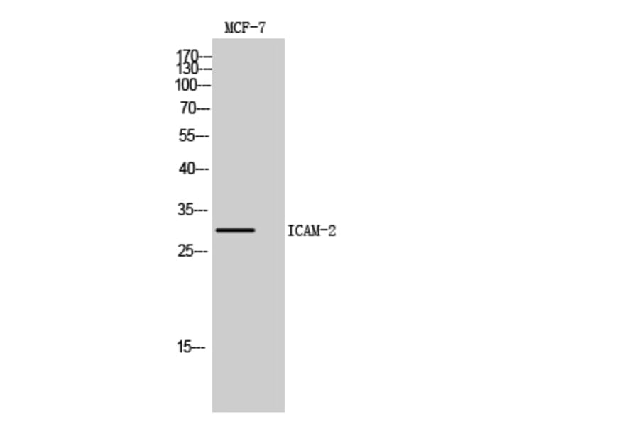 Western blot - ICAM-2 Polyclonal Antibody from Signalway Antibody (41966) - Antibodies.com
