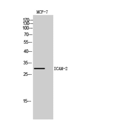 Western blot - ICAM-2 Polyclonal Antibody from Signalway Antibody (41966) - Antibodies.com