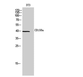 Western blot - CD158a Polyclonal Antibody from Signalway Antibody (41983) - Antibodies.com