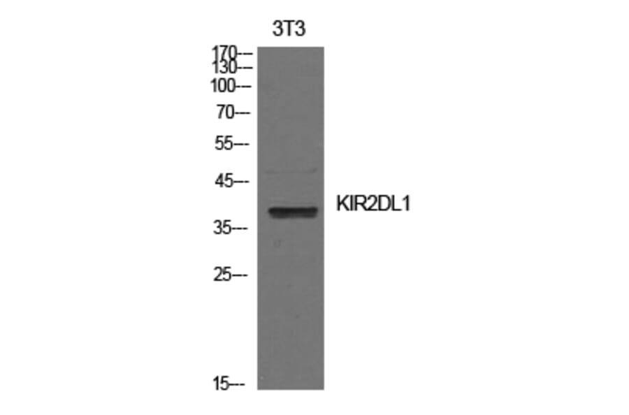 Western blot - CD158a Polyclonal Antibody from Signalway Antibody (41983) - Antibodies.com