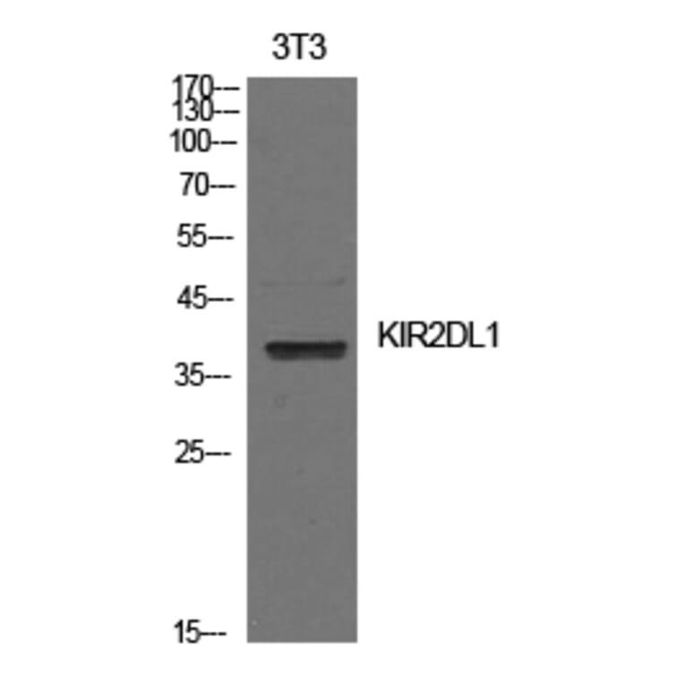 Western blot - CD158a Polyclonal Antibody from Signalway Antibody (41983) - Antibodies.com