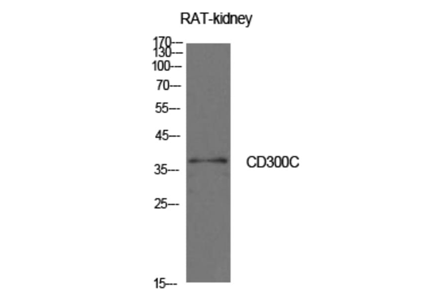 Western blot - CD300c Polyclonal Antibody from Signalway Antibody (41984) - Antibodies.com