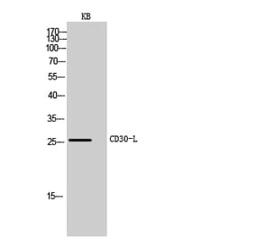 Western blot - CD30-L Polyclonal Antibody from Signalway Antibody (41986) - Antibodies.com