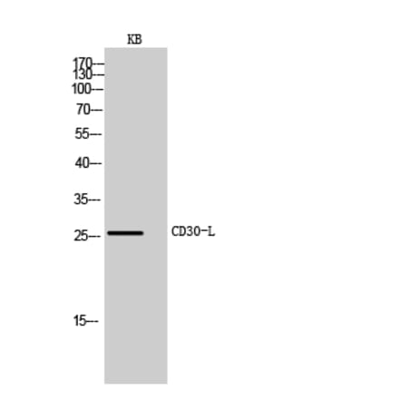 Western blot - CD30-L Polyclonal Antibody from Signalway Antibody (41986) - Antibodies.com