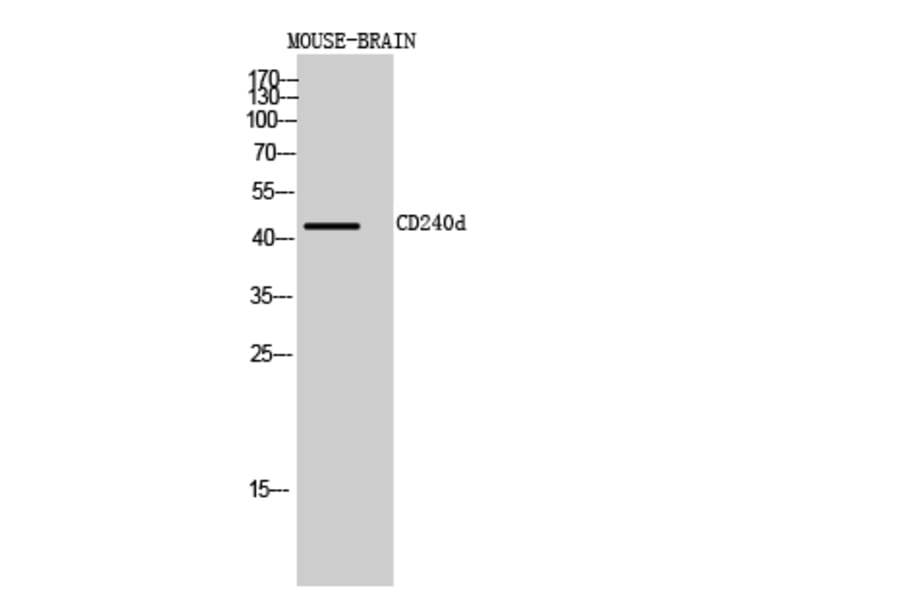 Western blot - CD240d Polyclonal Antibody from Signalway Antibody (41990) - Antibodies.com