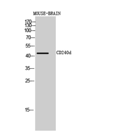 Western blot - CD240d Polyclonal Antibody from Signalway Antibody (41990) - Antibodies.com