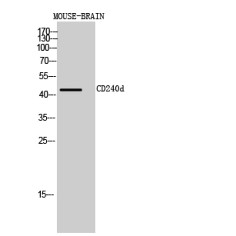 Western blot - CD240d Polyclonal Antibody from Signalway Antibody (41990) - Antibodies.com