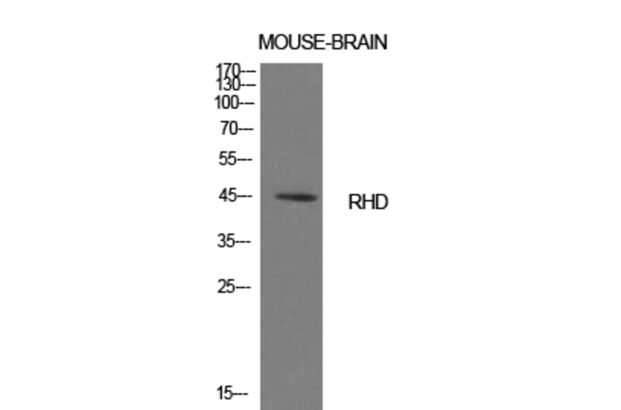Western blot - CD240d Polyclonal Antibody from Signalway Antibody (41990) - Antibodies.com