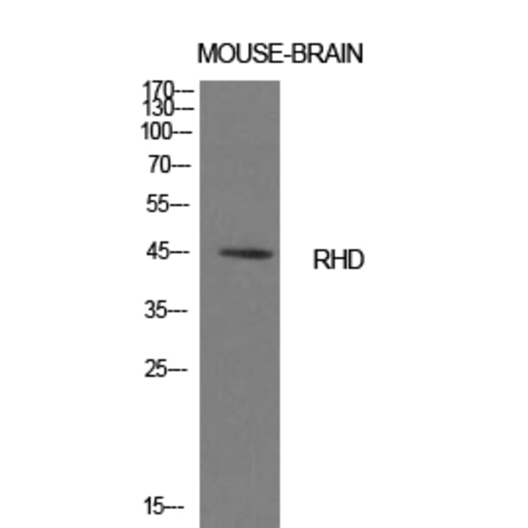 Western blot - CD240d Polyclonal Antibody from Signalway Antibody (41990) - Antibodies.com