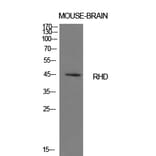 Western blot - CD240d Polyclonal Antibody from Signalway Antibody (41990) - Antibodies.com