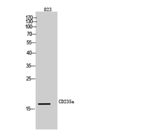Western blot - CD235a Polyclonal Antibody from Signalway Antibody (42002) - Antibodies.com