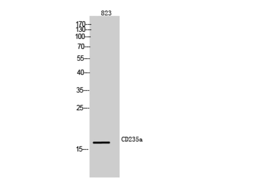 Western blot - CD235a Polyclonal Antibody from Signalway Antibody (42002) - Antibodies.com