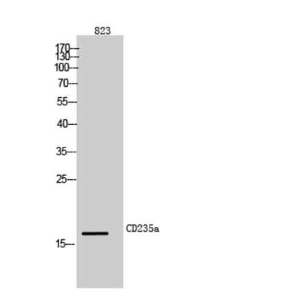 Western blot - CD235a Polyclonal Antibody from Signalway Antibody (42002) - Antibodies.com