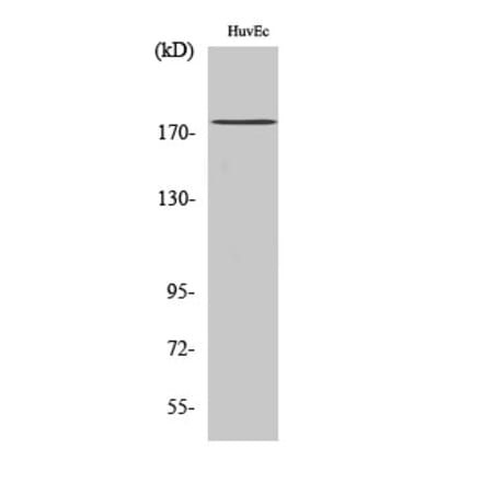 Western blot - ABCA8 Polyclonal Antibody from Signalway Antibody (40532) - Antibodies.com