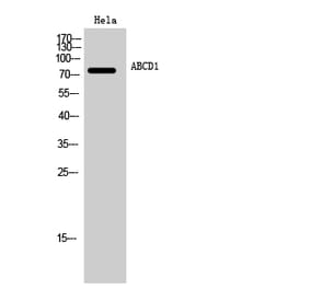 Western blot - ABCD1 Polyclonal Antibody from Signalway Antibody (40535) - Antibodies.com