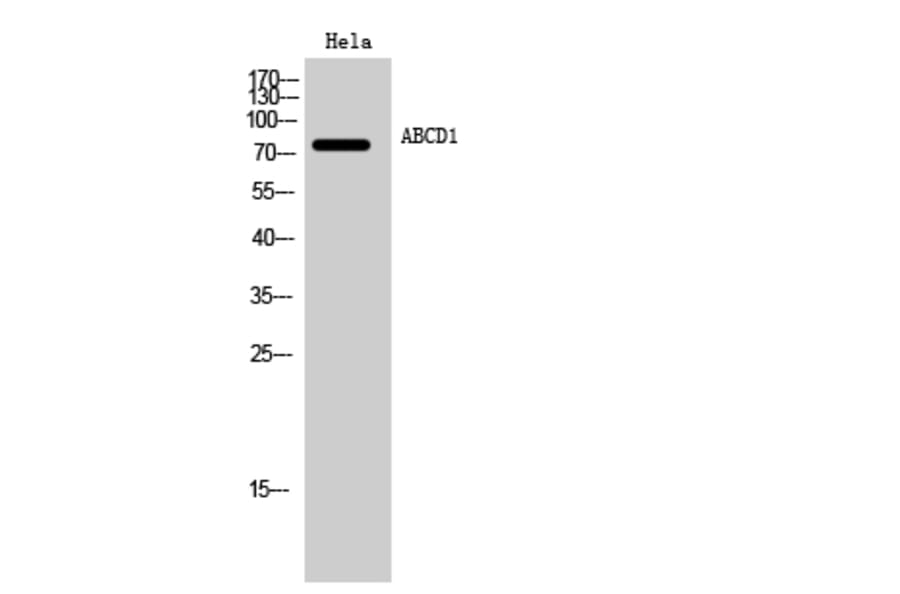 Western blot - ABCD1 Polyclonal Antibody from Signalway Antibody (40535) - Antibodies.com