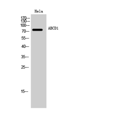 Western blot - ABCD1 Polyclonal Antibody from Signalway Antibody (40535) - Antibodies.com