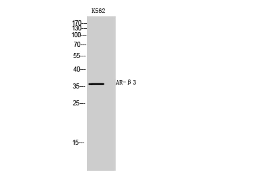 Western blot - AR-β3 Polyclonal Antibody from Signalway Antibody (40617) - Antibodies.com