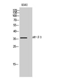 Western blot - AR-β3 Polyclonal Antibody from Signalway Antibody (40617) - Antibodies.com