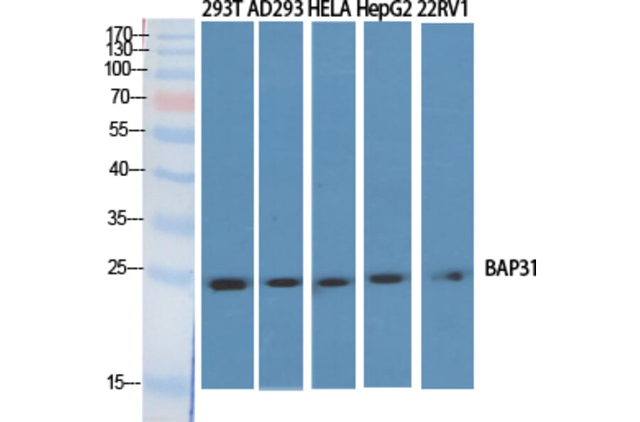 Western blot - BAP31 Polyclonal Antibody from Signalway Antibody (40634) - Antibodies.com