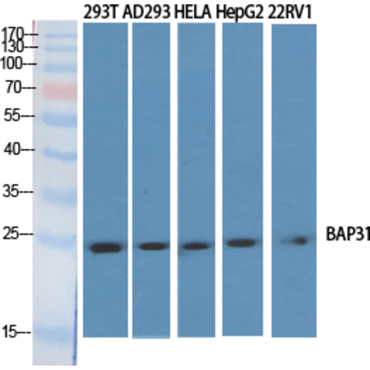 Western blot - BAP31 Polyclonal Antibody from Signalway Antibody (40634) - Antibodies.com