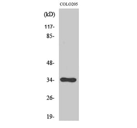 Western blot - Cdc34 Polyclonal Antibody from Signalway Antibody (40715) - Antibodies.com