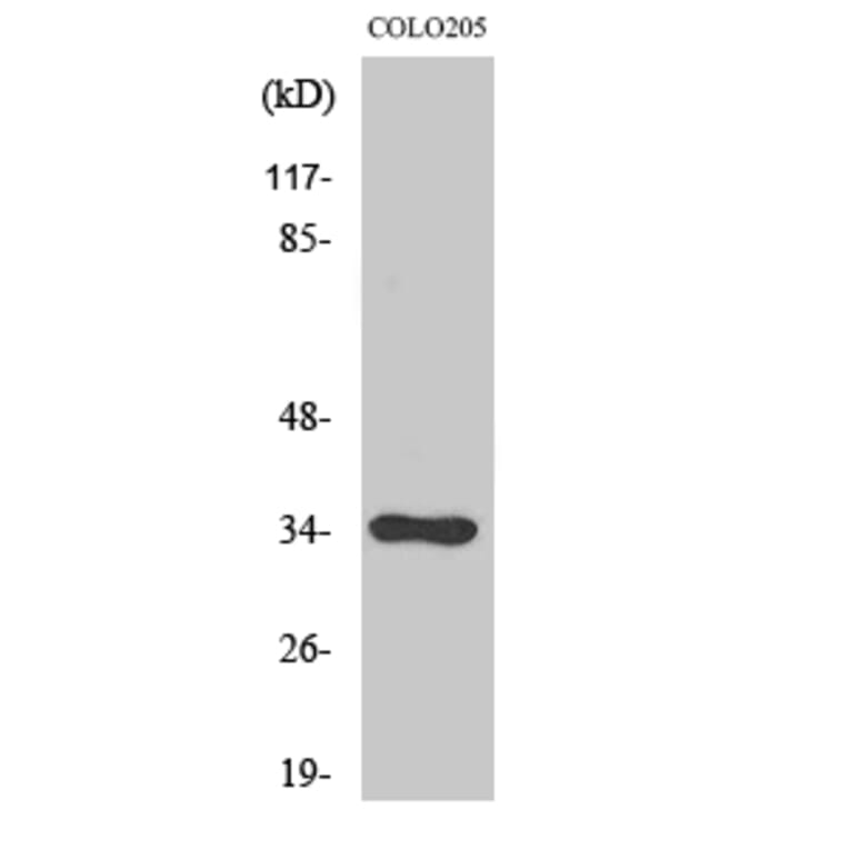 Western blot - Cdc34 Polyclonal Antibody from Signalway Antibody (40715) - Antibodies.com