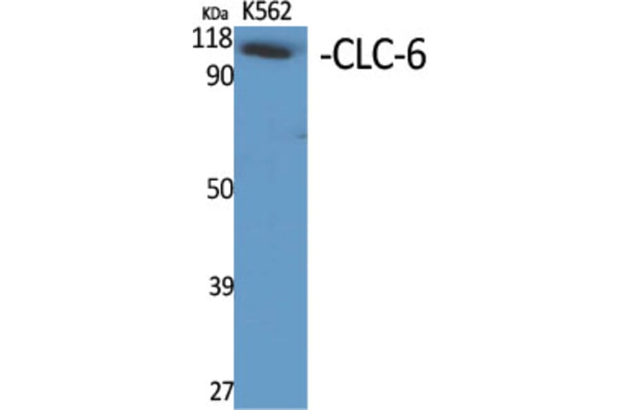 Western blot - CLC-6 Polyclonal Antibody from Signalway Antibody (40756) - Antibodies.com