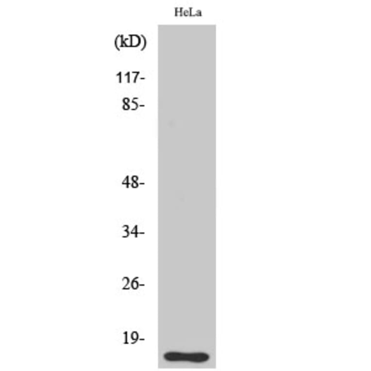 Western blot - DOC-1 Polyclonal Antibody from Signalway Antibody (40849) - Antibodies.com