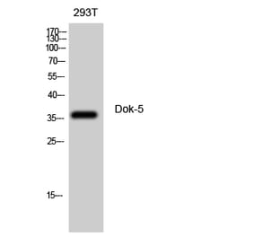 Western blot - Dok-5 Polyclonal Antibody from Signalway Antibody (40850) - Antibodies.com