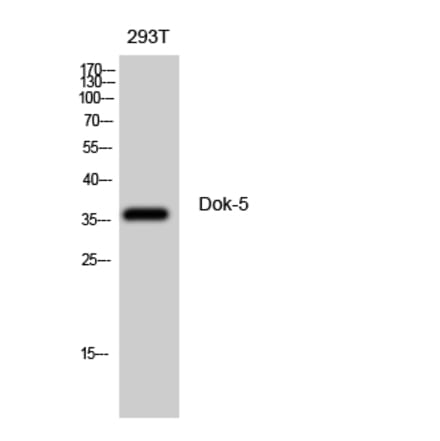 Western blot - Dok-5 Polyclonal Antibody from Signalway Antibody (40850) - Antibodies.com