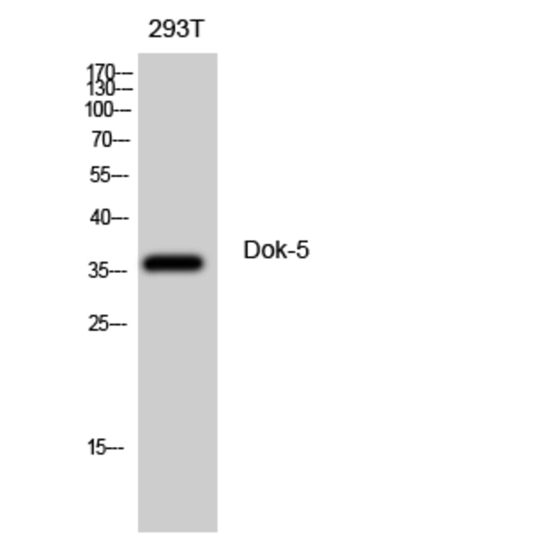 Western blot - Dok-5 Polyclonal Antibody from Signalway Antibody (40850) - Antibodies.com